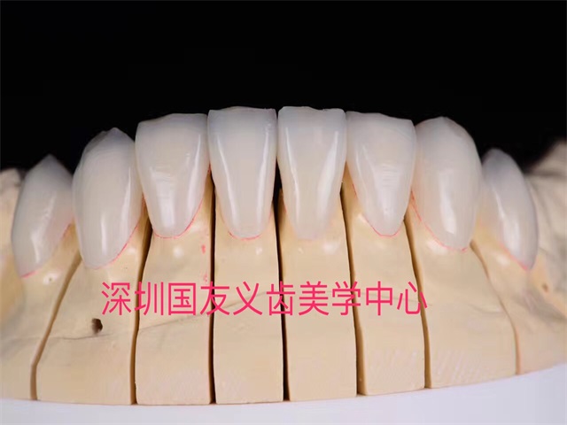 义齿大师工作室产品