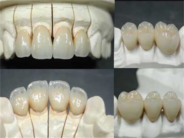 义齿大师工作室产品