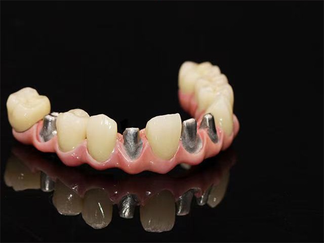 义齿大师工作室产品