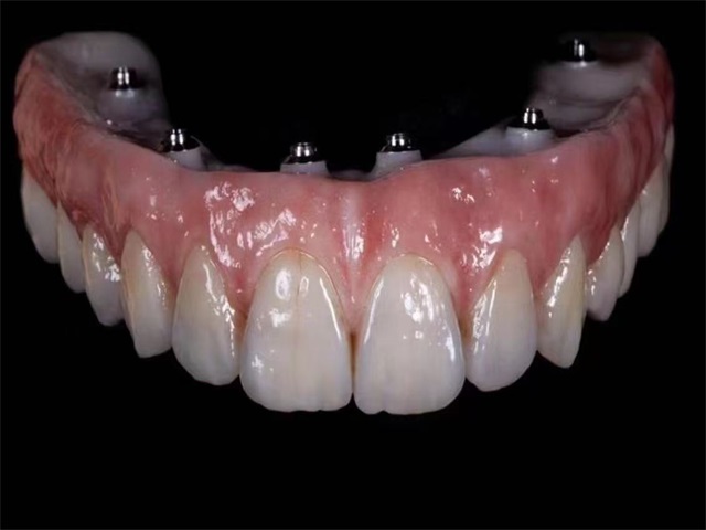 义齿大师工作室产品