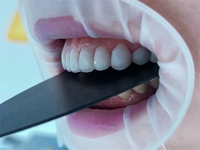 义齿大师工作室产品